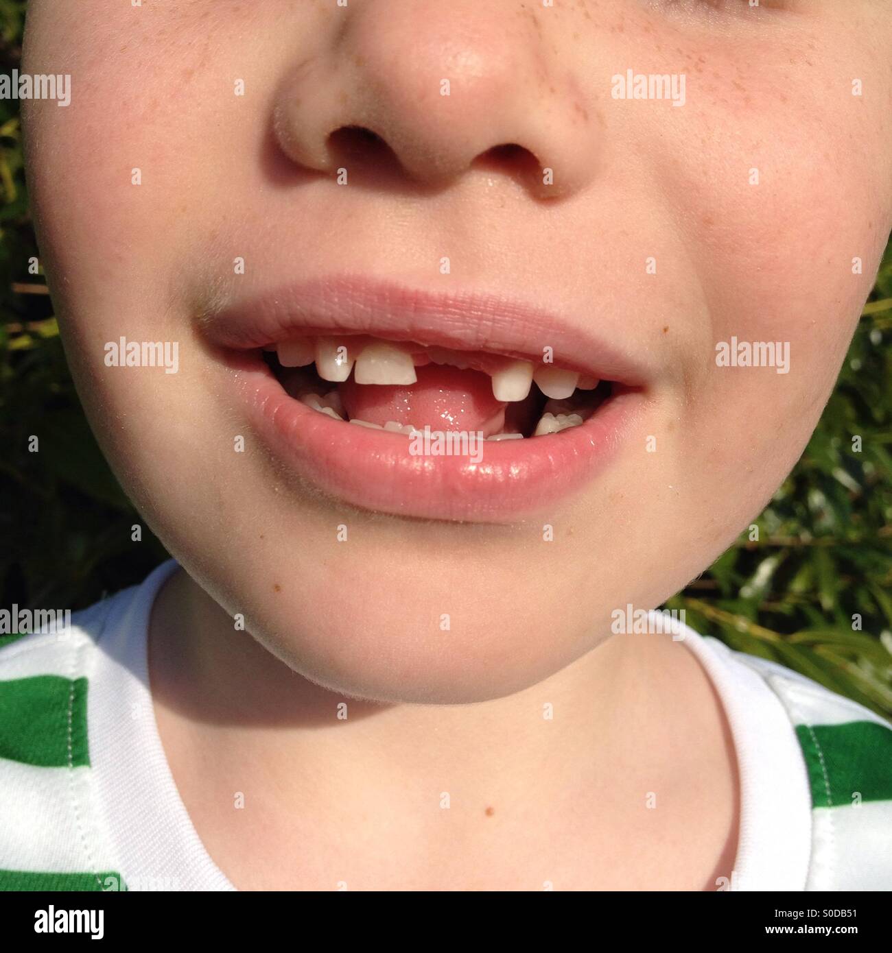 Boy with front tooth missing Stock Photo