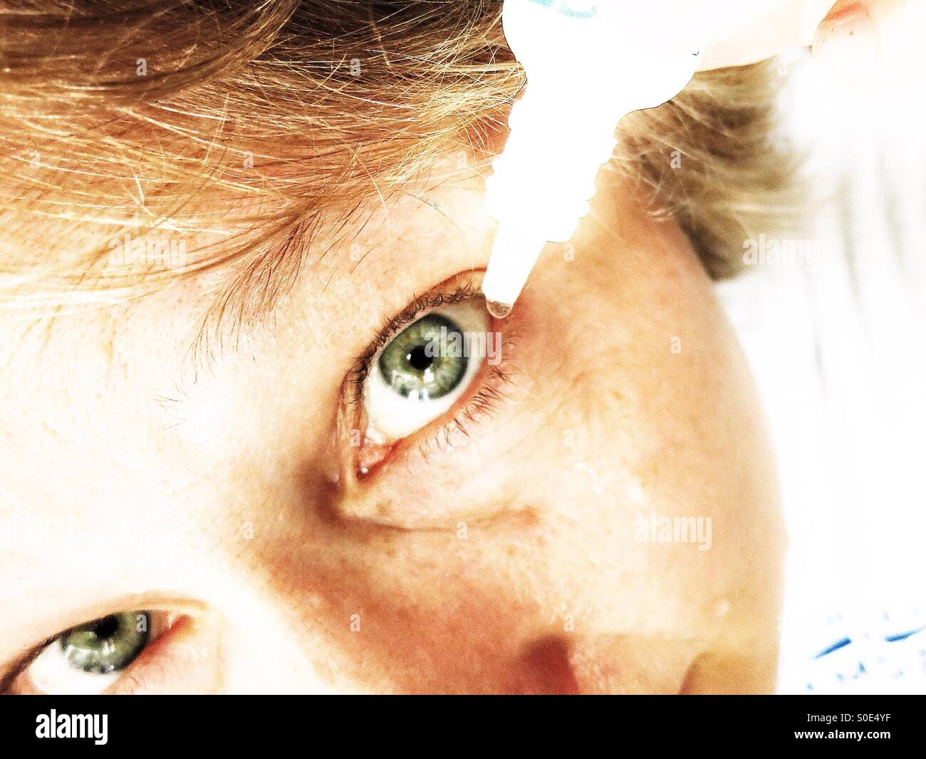 Hayfever and eyes hires stock photography and images Alamy