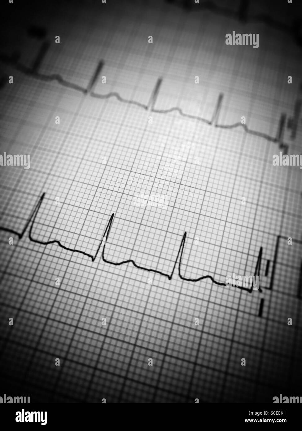Ecg of heart Black and White Stock Photos & Images - Alamy
