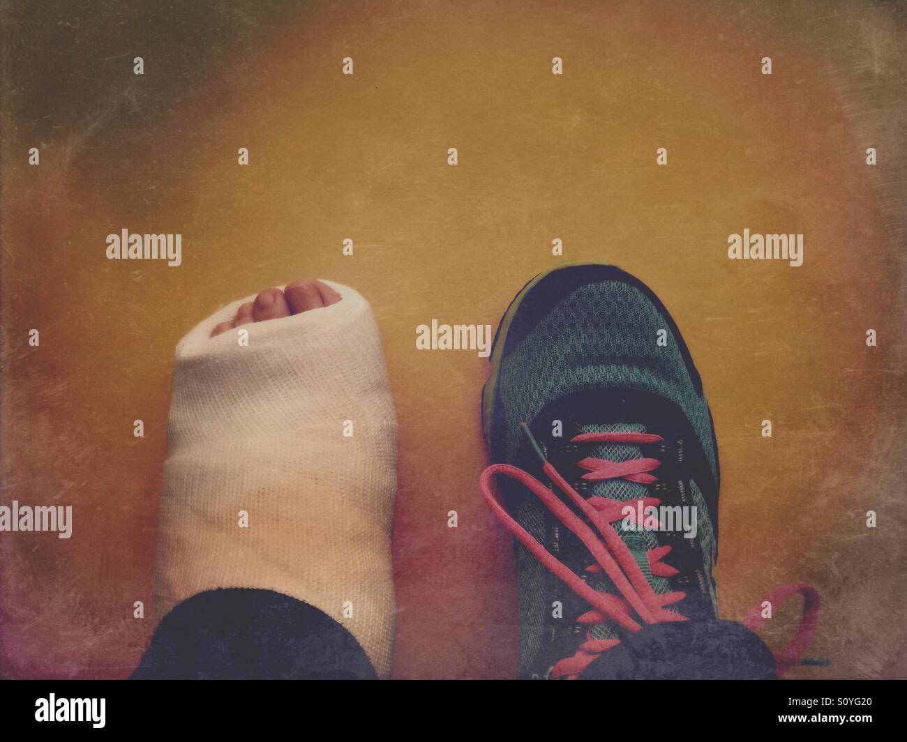 Foot plaster cast hires stock photography and images Alamy