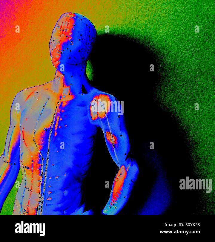 Acupuncture figure with copy space - Smartphone Captured Stock Image