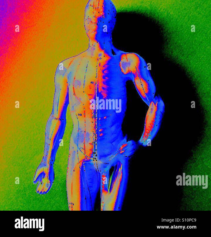 Multicolored acupuncture man - Smartphone Captured Stock Image