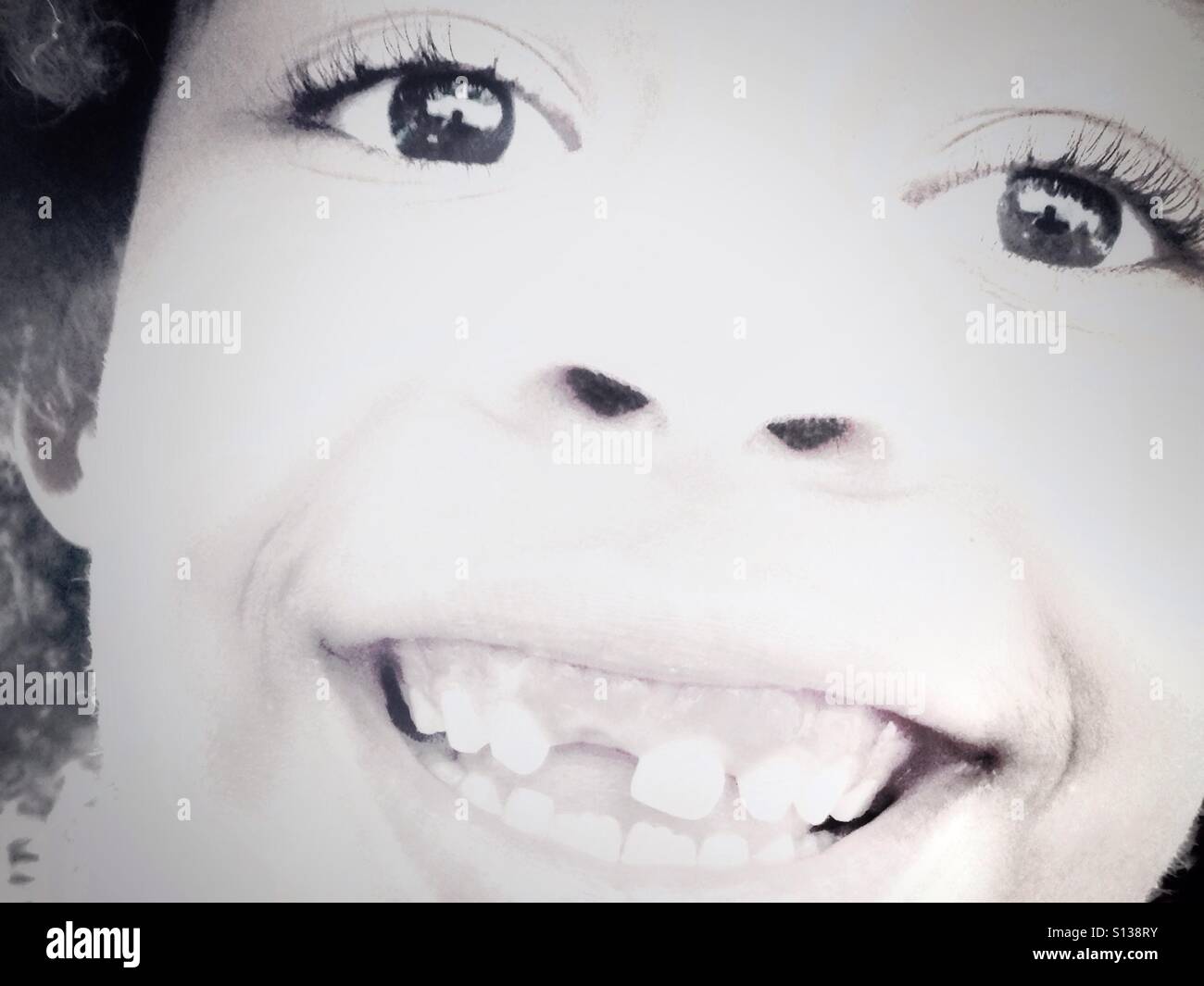 Smiling child showing lost tooth. - Smartphone Captured Stock Image