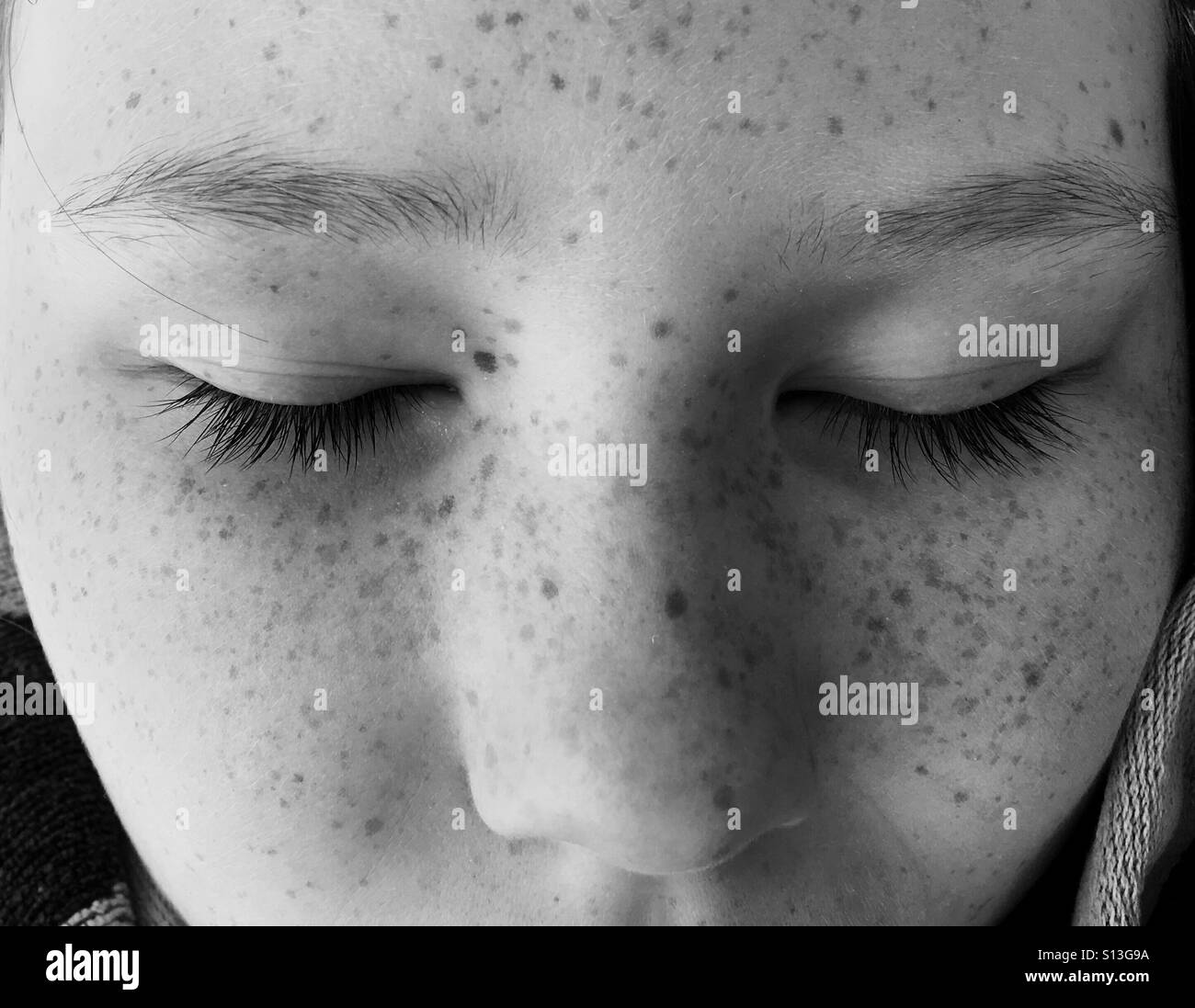 Freckles Stock Photo