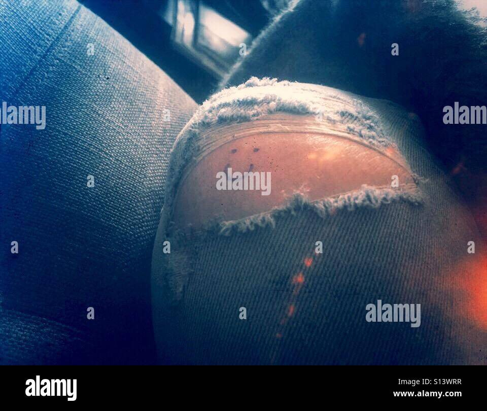 Smiley face on knee Stock Photo Alamy