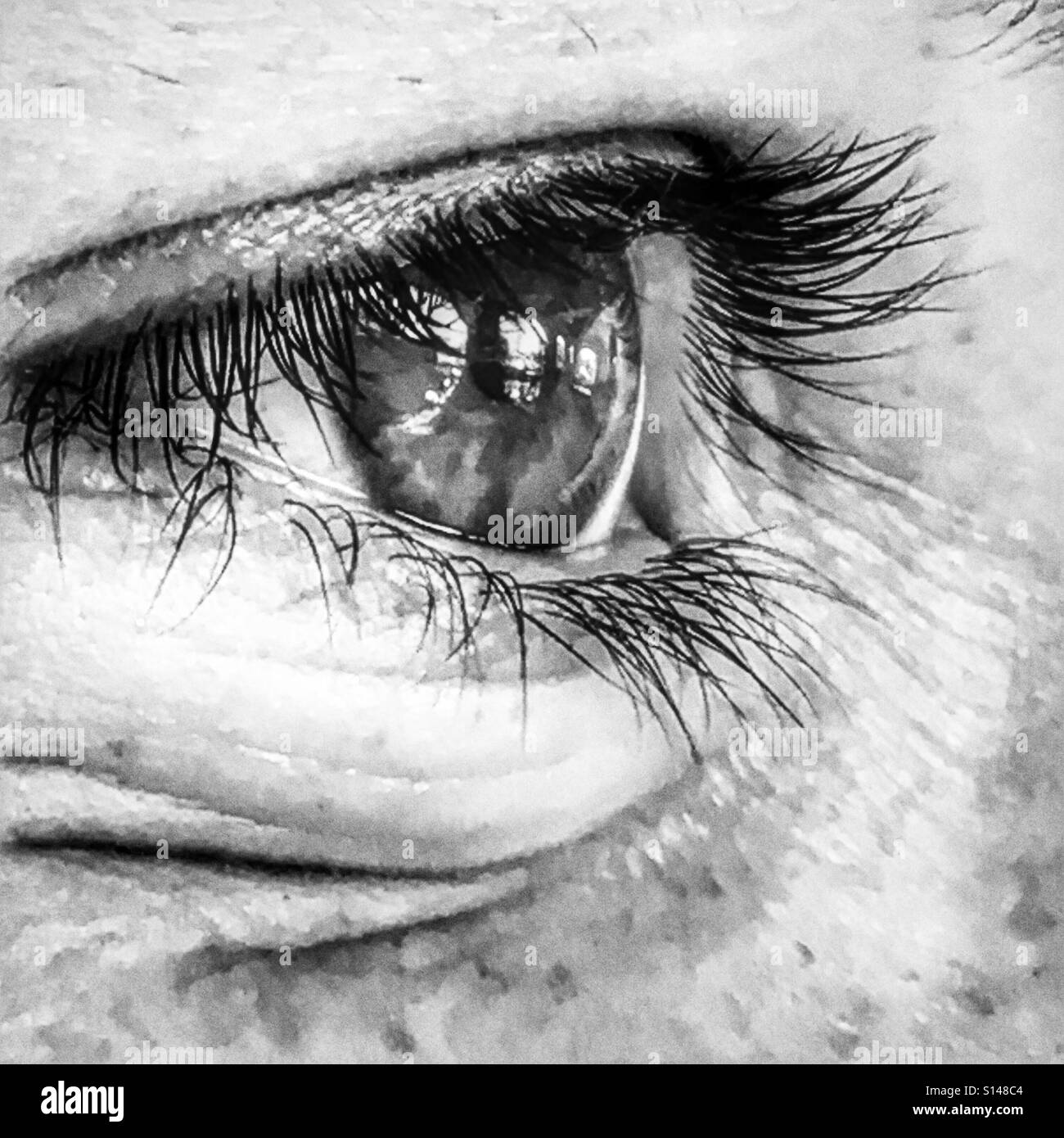 Teen with black eye Black and White Stock Photos & Images - Alamy