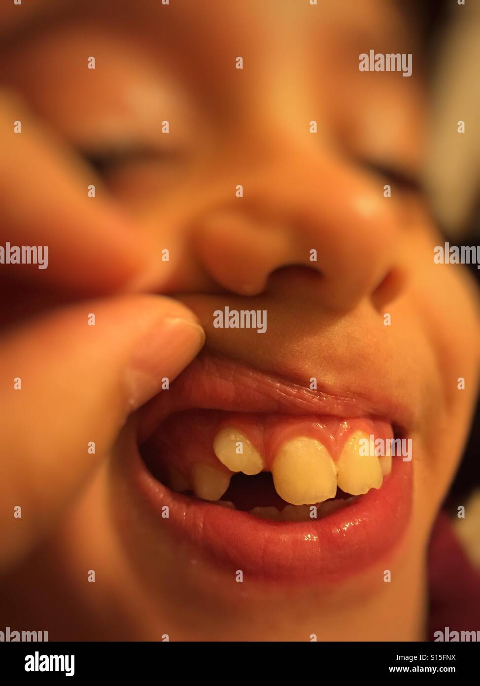 Eight years old boy me tooth - Smartphone Captured Stock Image