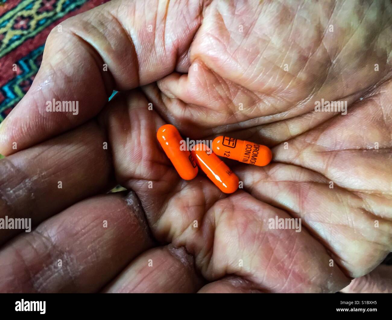 Strong opioids, three 12 mg capsules in the palm of a senior. Potent analgesic. Conceptual image suggesting possible addiction, dependence, overdosing, besides pain management. - Smartphone Captured Stock Image
