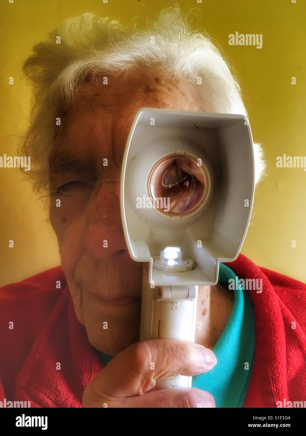 Old age pensioner with macular degeneration in her eyes - Smartphone Captured Stock Image