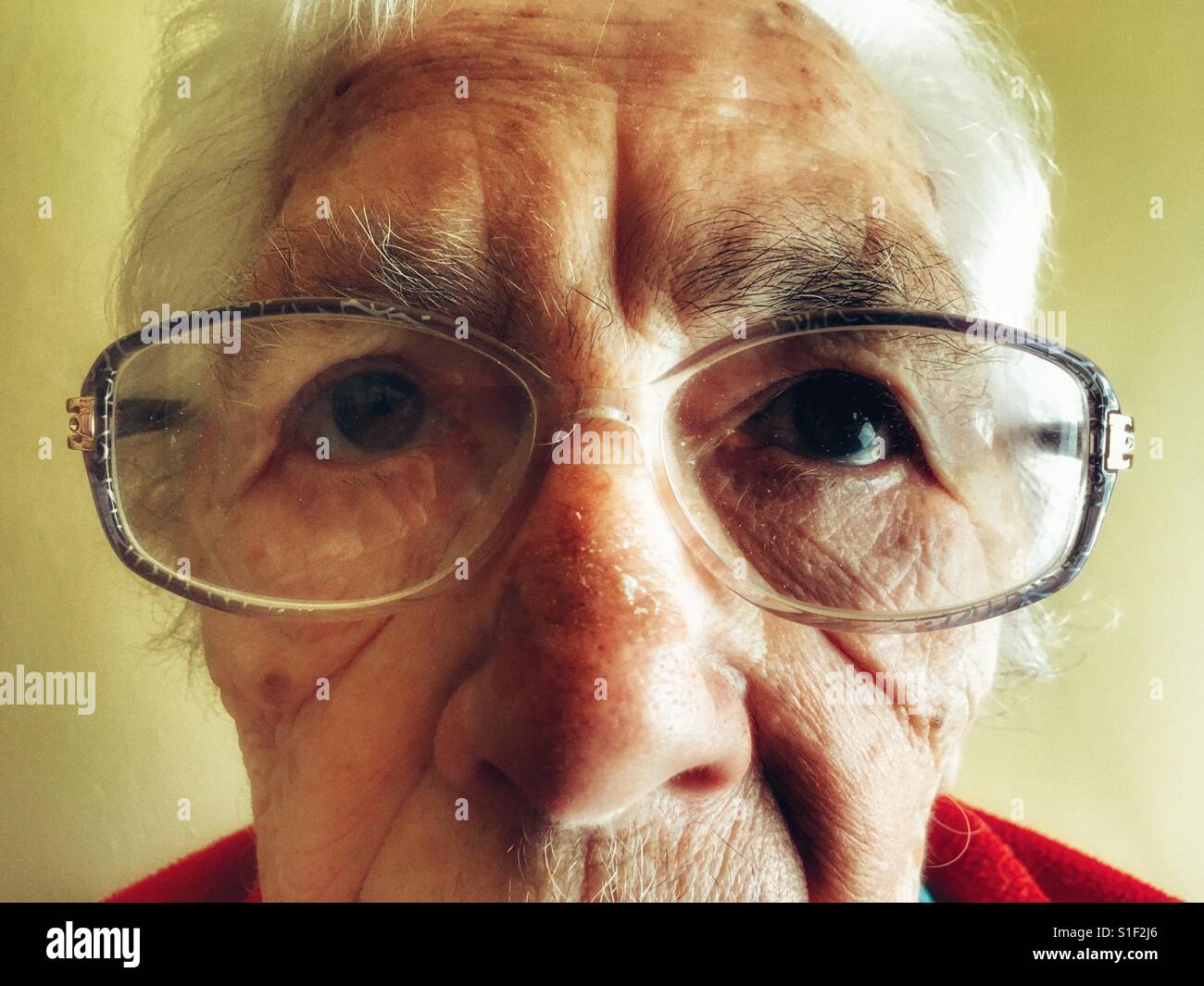 87-year old woman with macular degeneration in her eyes - Smartphone Captured Stock Image