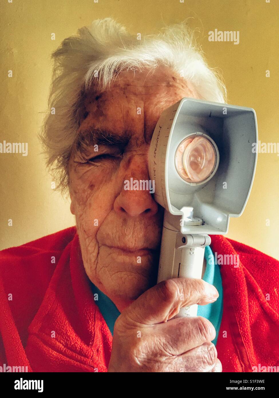Woman with macular degeneration in her eyes - Smartphone Captured Stock Image