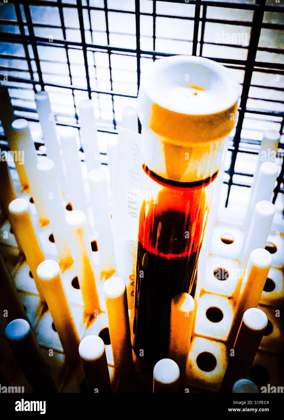 Blood in tube on laboratory rack Stock Photo