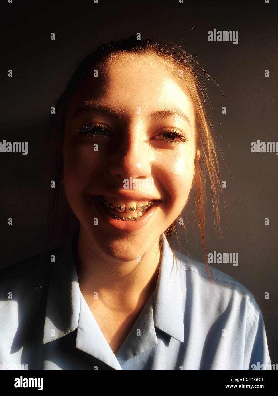 13-year old schoolgirl with brace on teeth Stock Photo