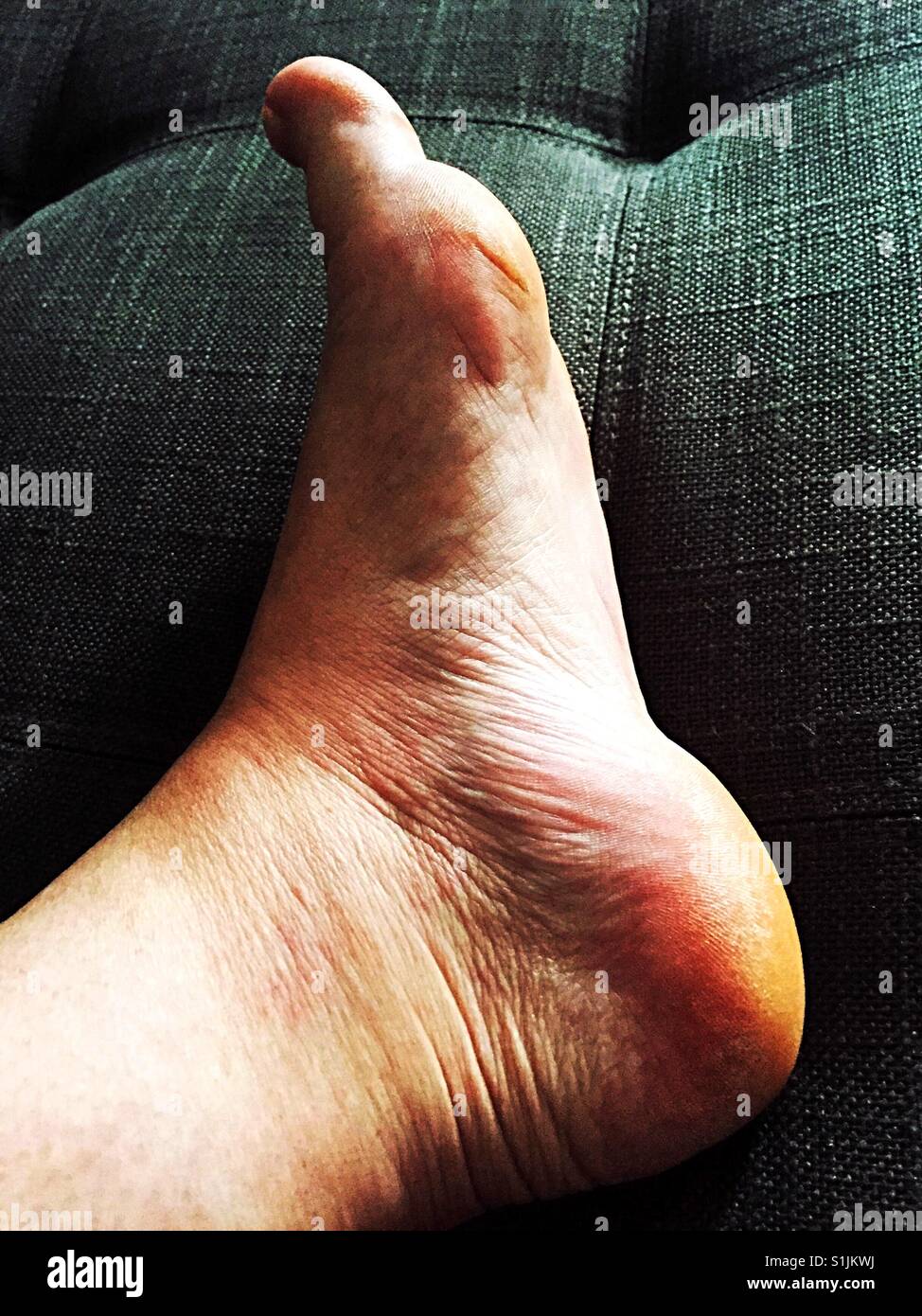Old, wrinkly, swollen feet Stock Photo