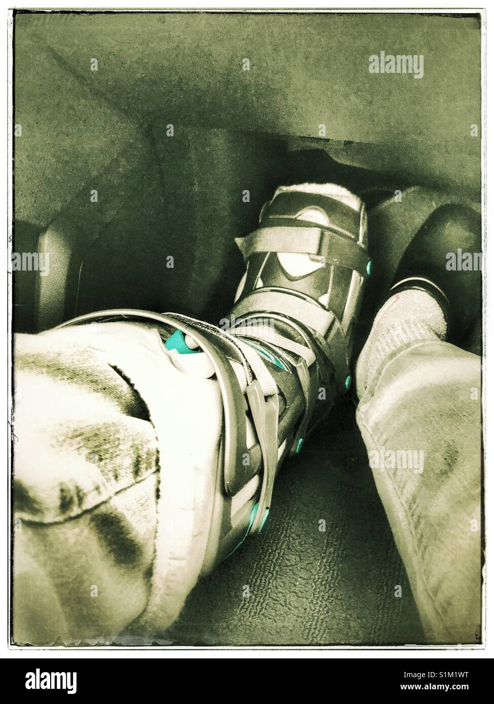 Injured foot in moon boot. - Smartphone Captured Stock Image