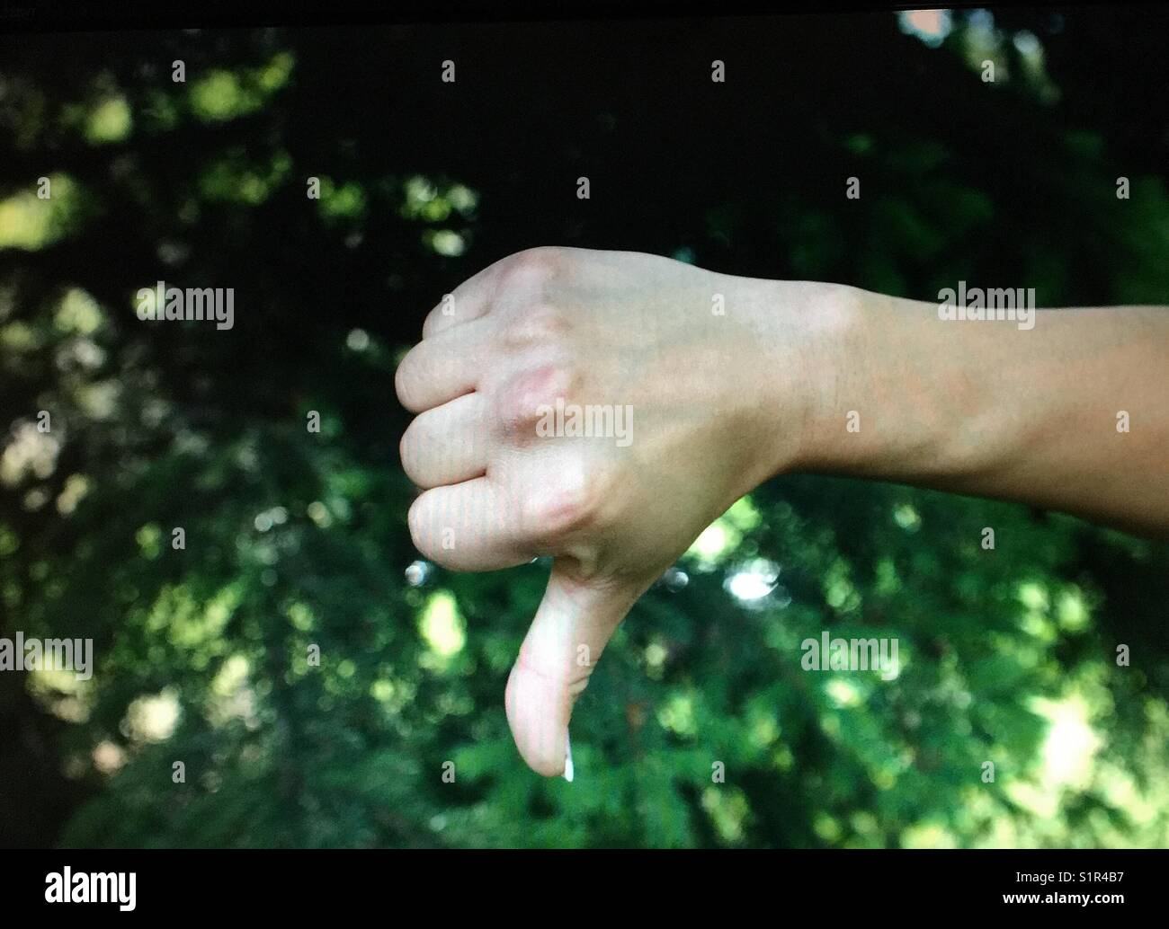 Thumbs down - Smartphone Captured Stock Image