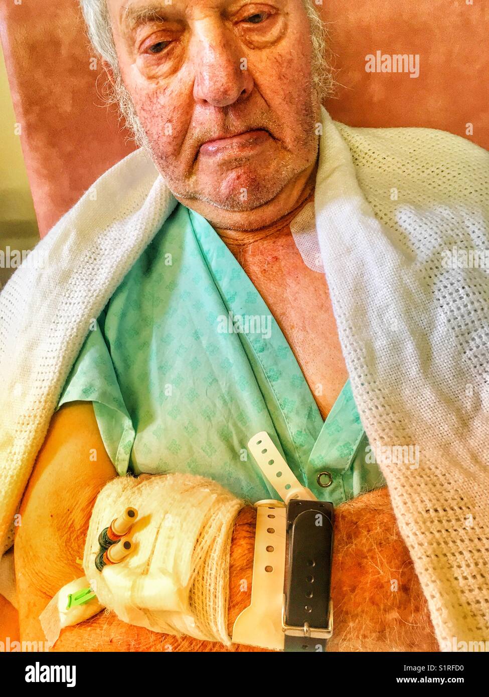 Elderly man recovering in hospital after having heart pacemaker fitted - Smartphone Captured Stock Image