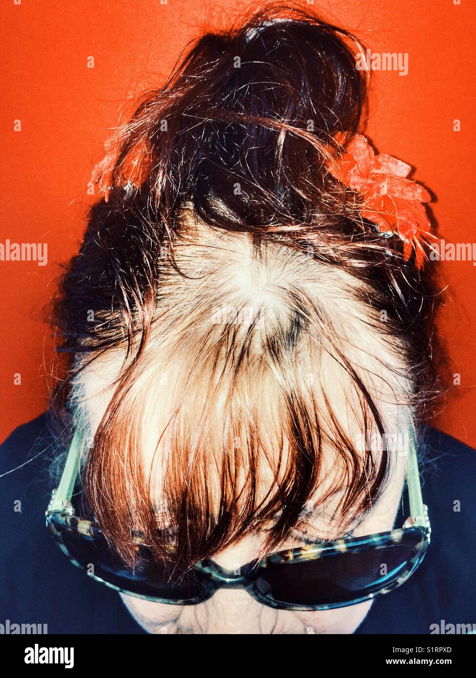 Womans Hair Going Thin On Top Stock Photos Womans Hair Going
