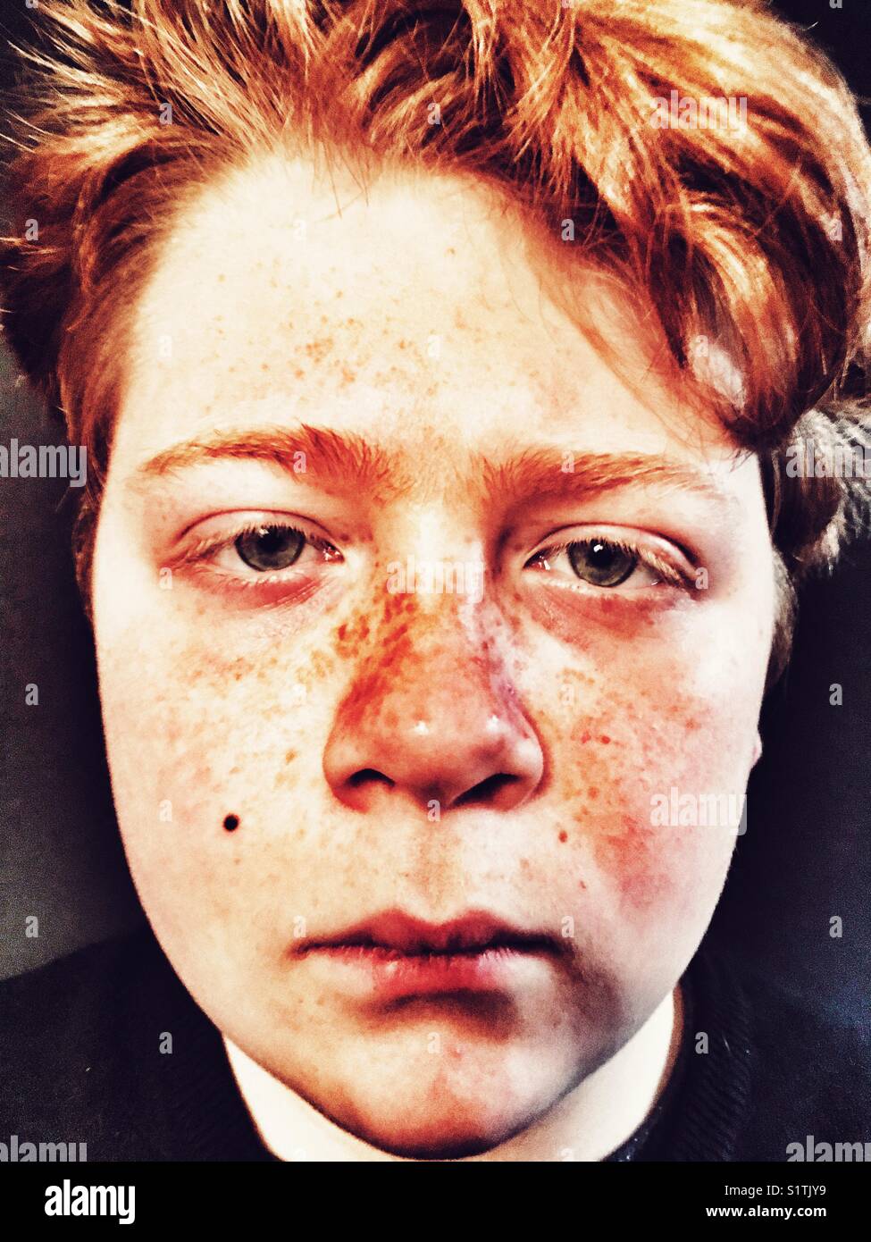 Boy with freckles Stock Photo