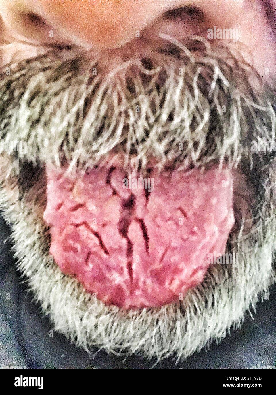 Cracked tongue close up - Smartphone Captured Stock Image