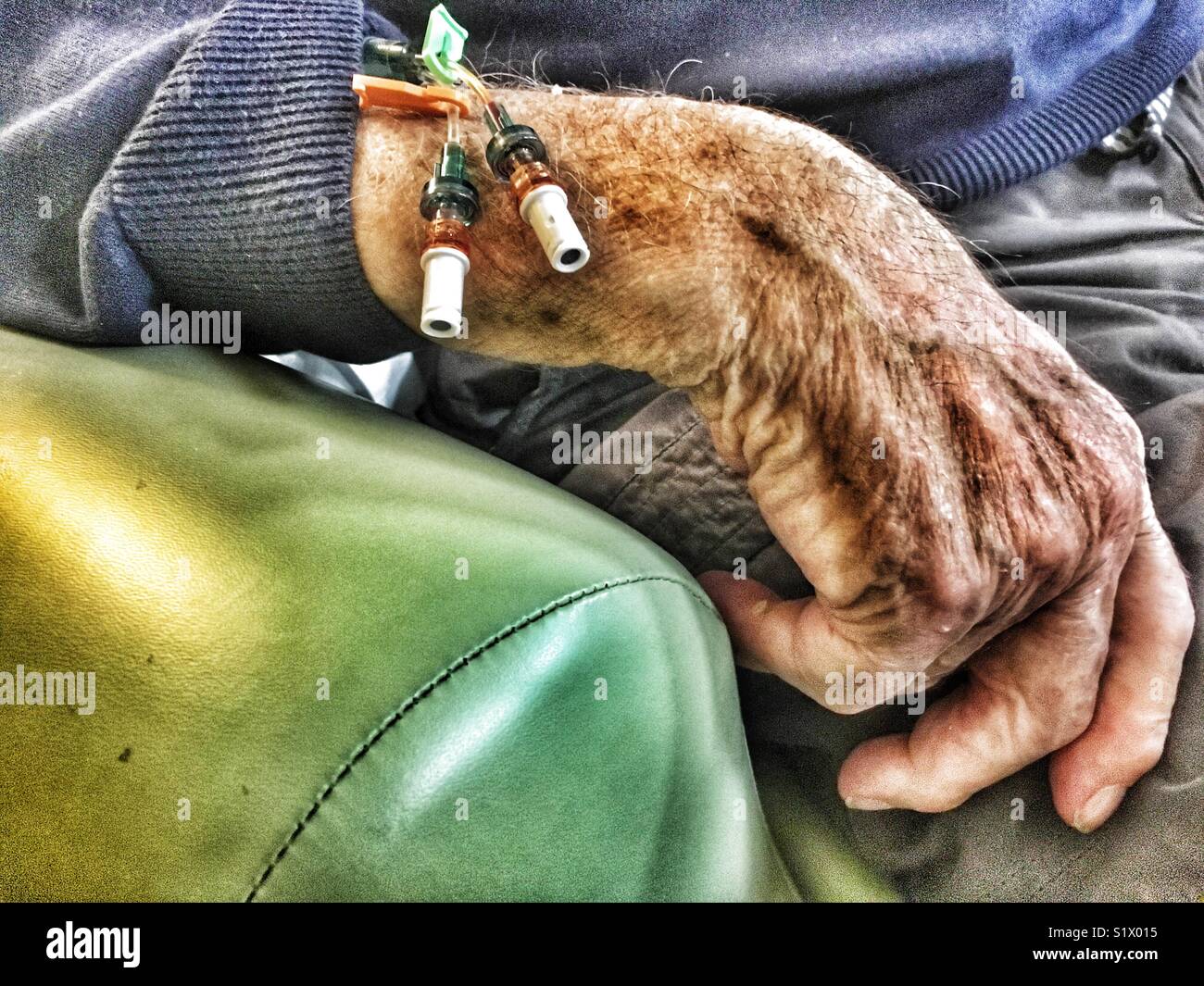 Elderly patient in hospital with drip feed - Smartphone Captured Stock Image