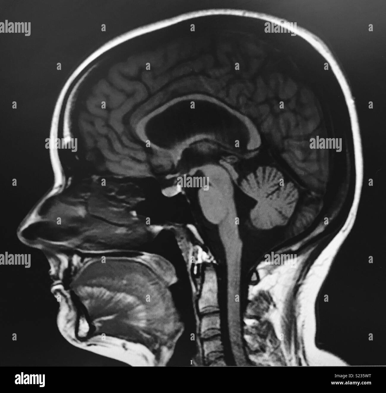 Mri brain scan hi-res stock photography and images - Alamy