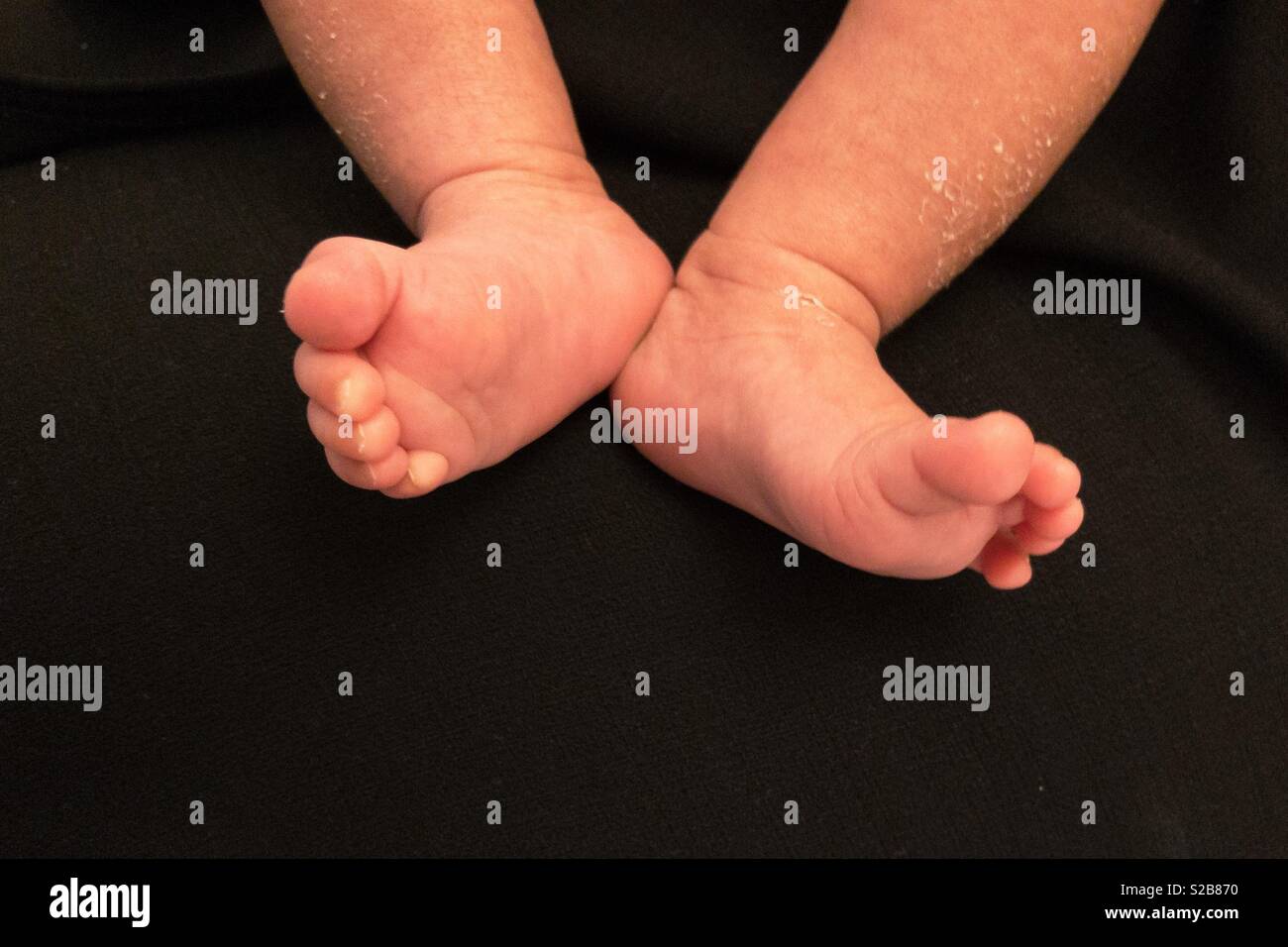 Newborn Baby’s feet Stock Photo - Alamy