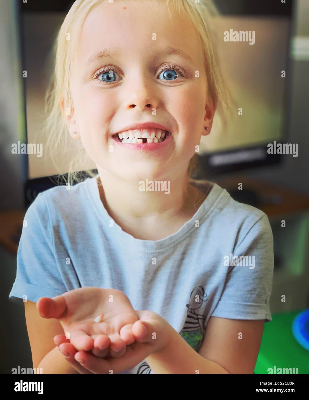 5 year old loosing her first tooth Stock Photo