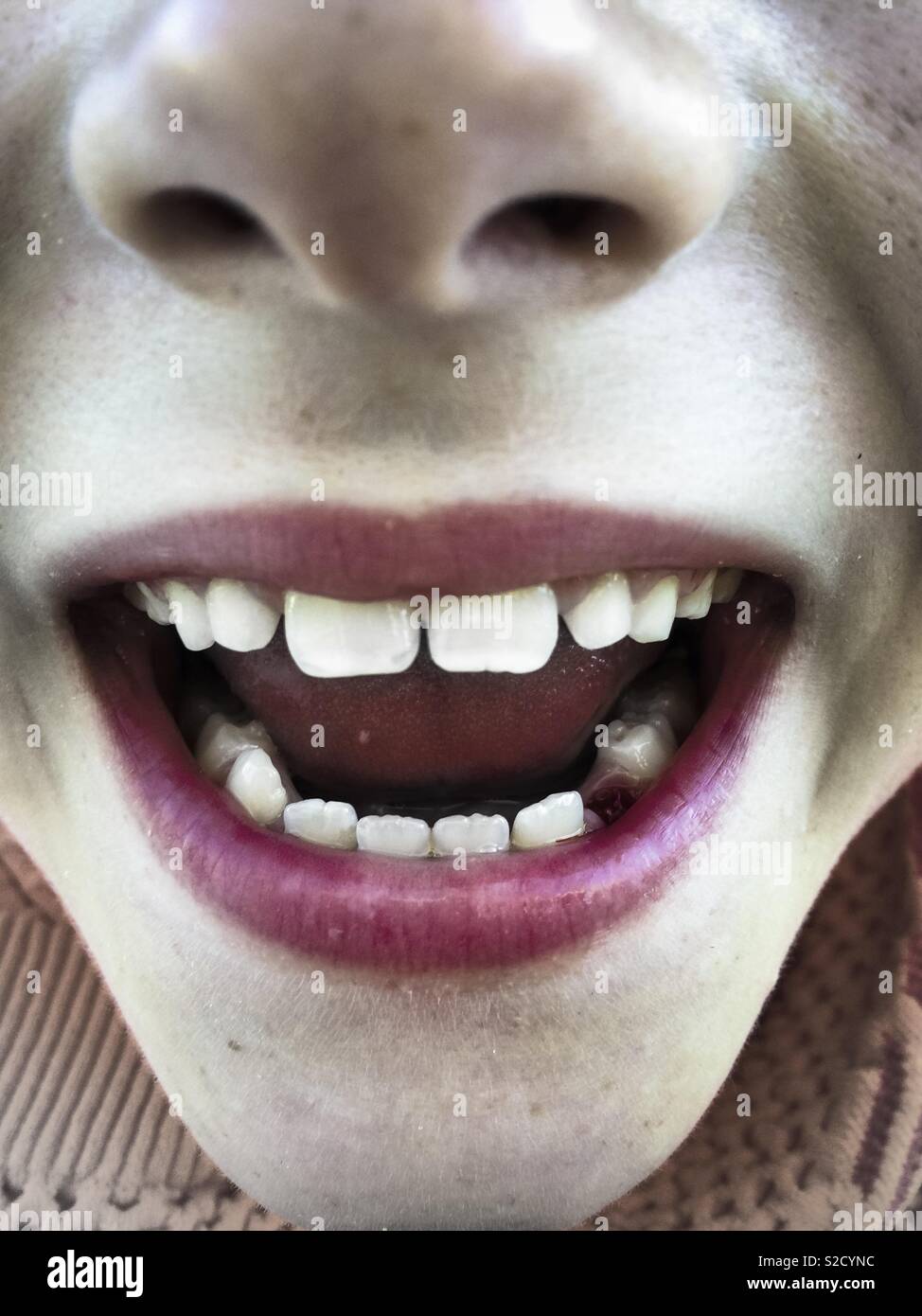 Close up of an smiling child mouth. Healthy teeth - Smartphone Captured Stock Image