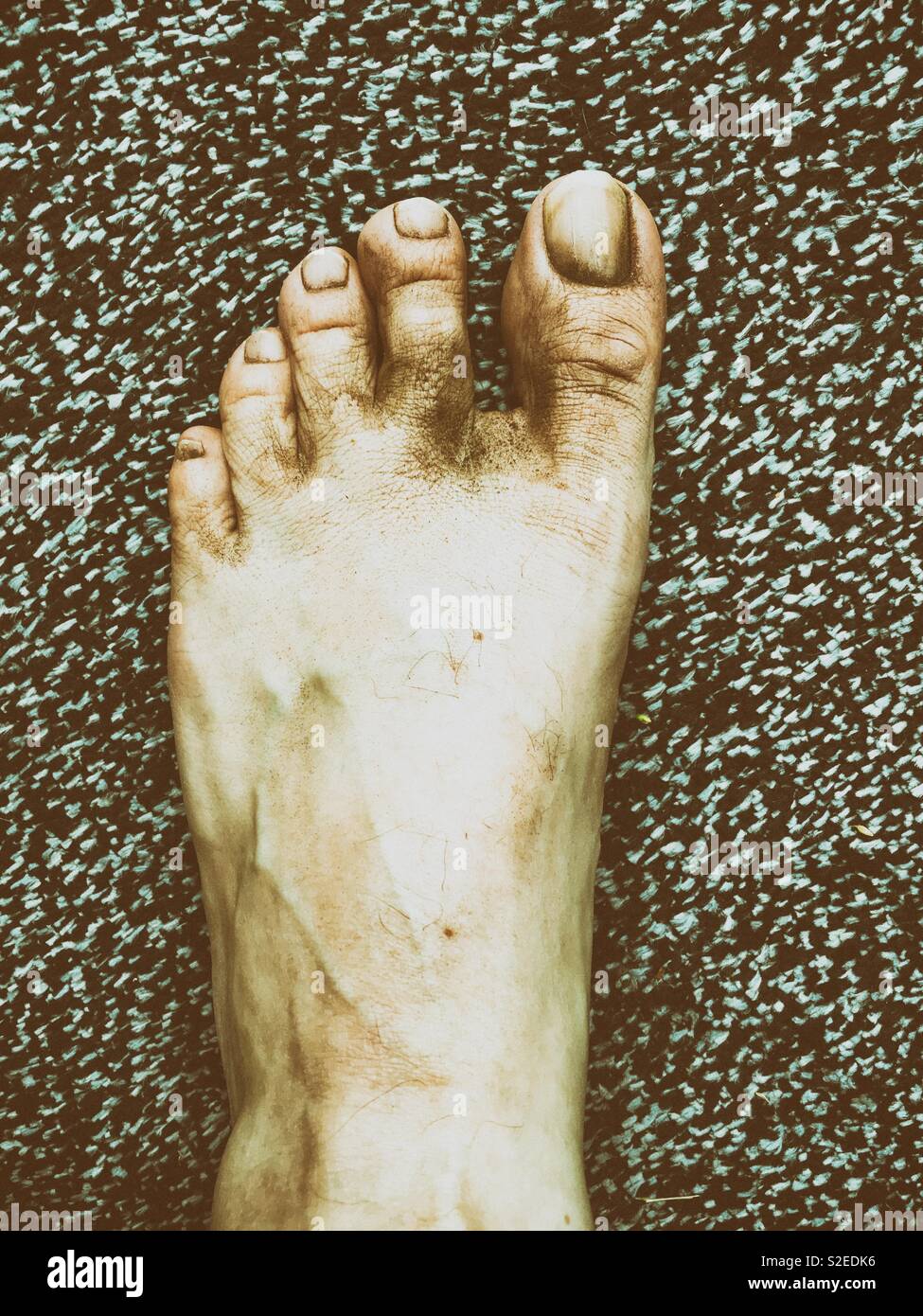 Dirty foot - Smartphone Captured Stock Image