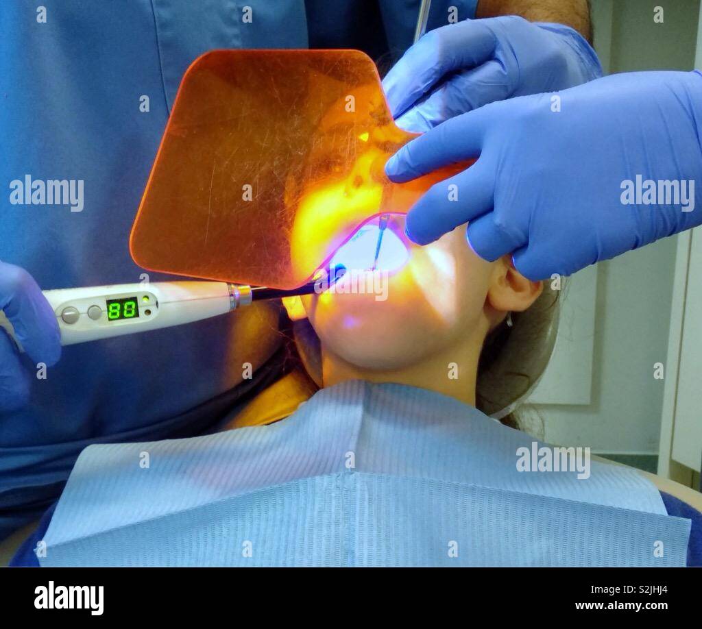 Dentist performing dental fissure sealant procedure on ten year old