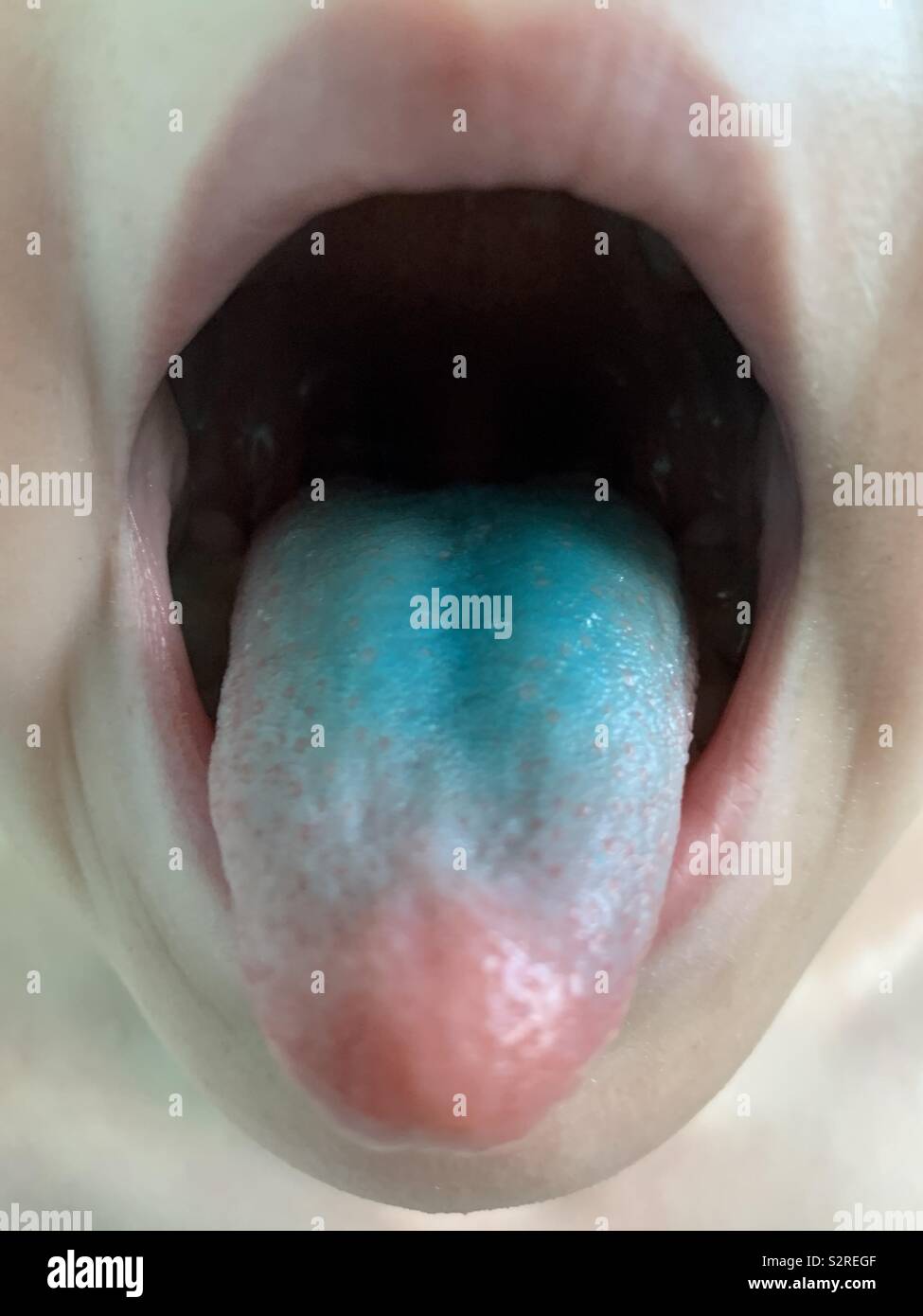 Blue tongue from eating sweets Stock Photo