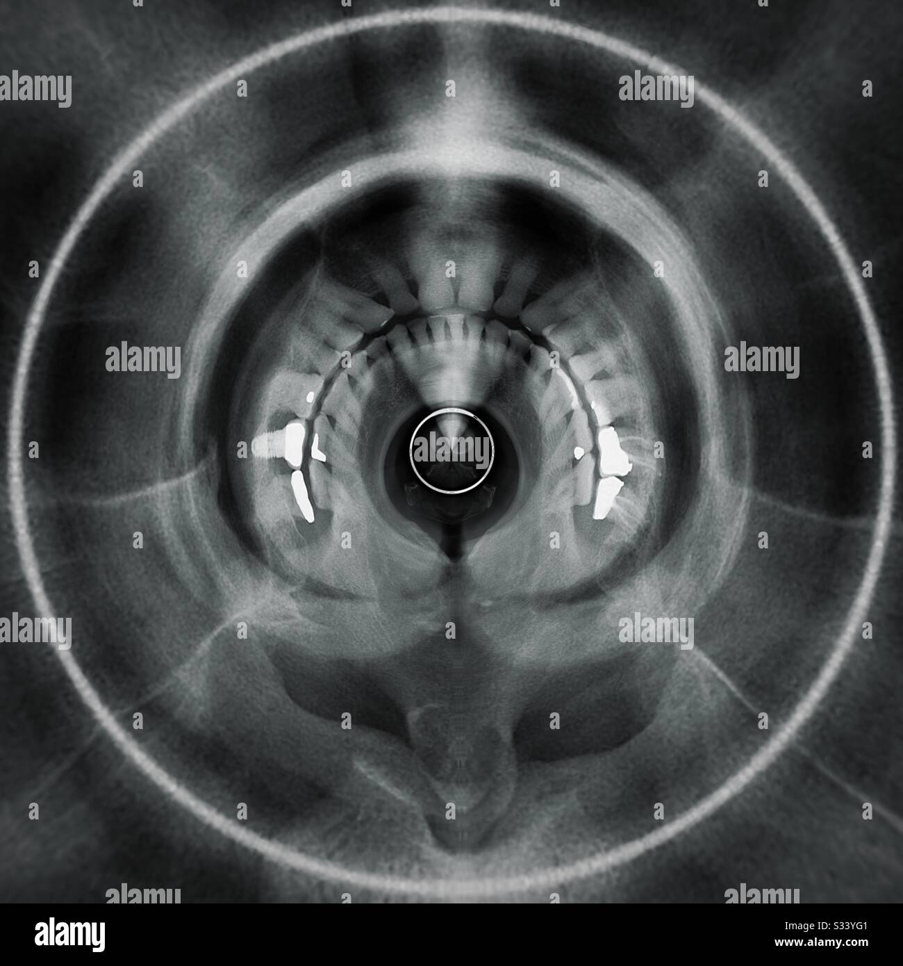 360 degree dental x-ray - Smartphone Captured Stock Image