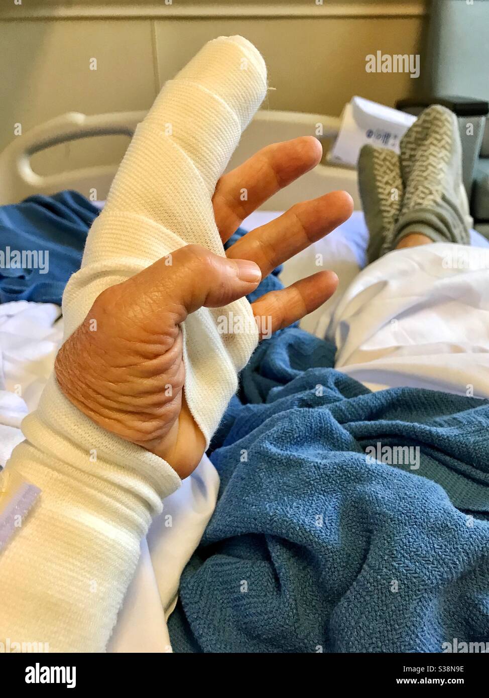 In the hospital after finger surgery for infected cat bite - Smartphone Captured Stock Image