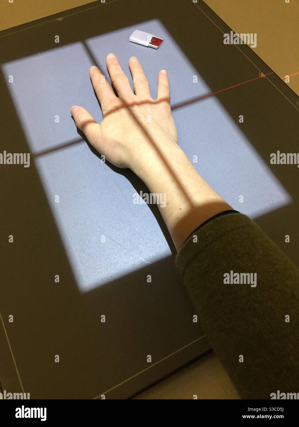 A Caucasian woman has her right hand x-rayed. - Smartphone Captured Stock Image