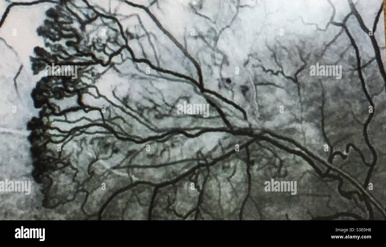 The tree in your eye hi-res stock photography and images - Alamy