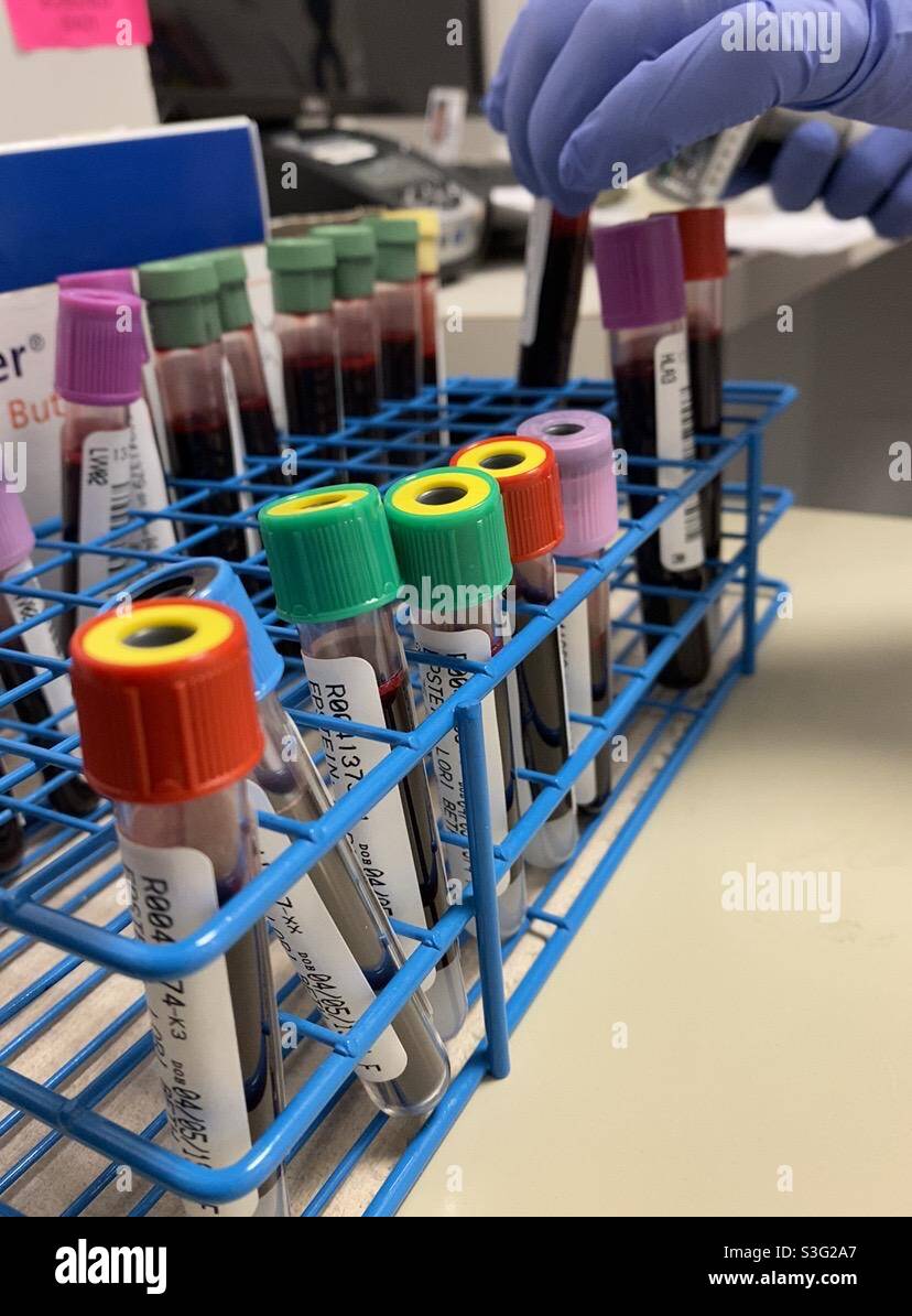 A medical researcher uses a scanner to keep track of vials of blood during a research study. - Smartphone Captured Stock Image
