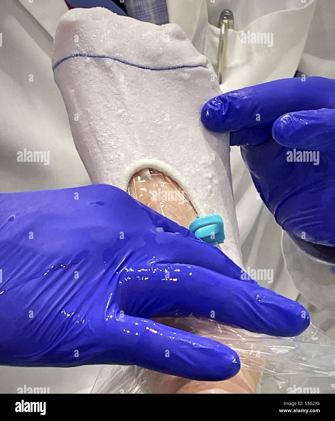 Podiatrist wearing rubber gloves fits a patient for a new orthotic mold, USA - Smartphone Captured Stock Image