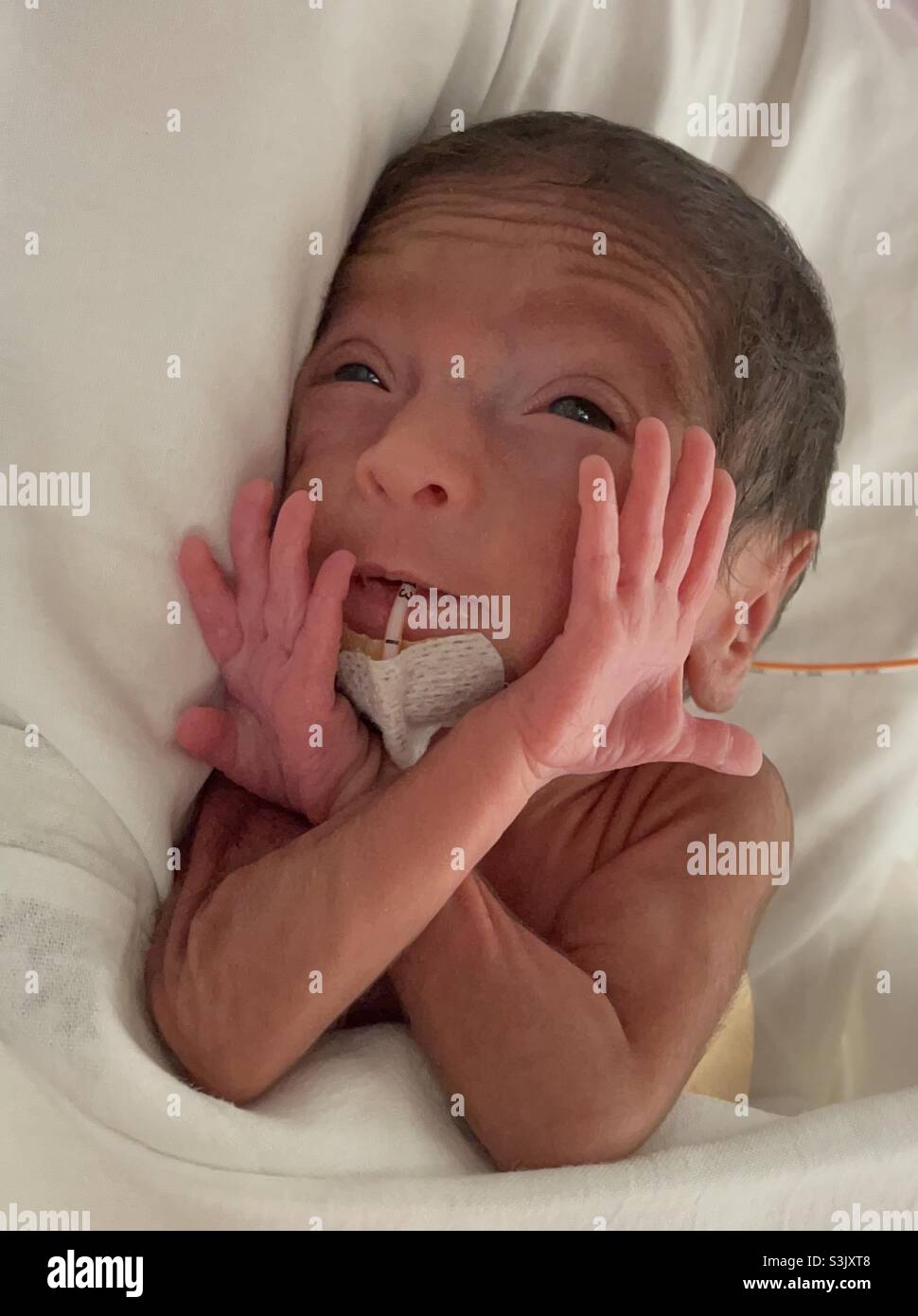 My precious preemie .. jazz hands Stock Photo