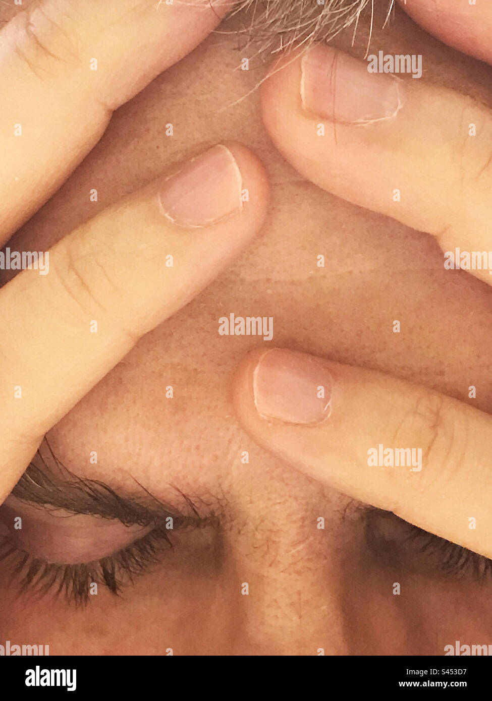 Man with a headache. - Smartphone Captured Stock Image