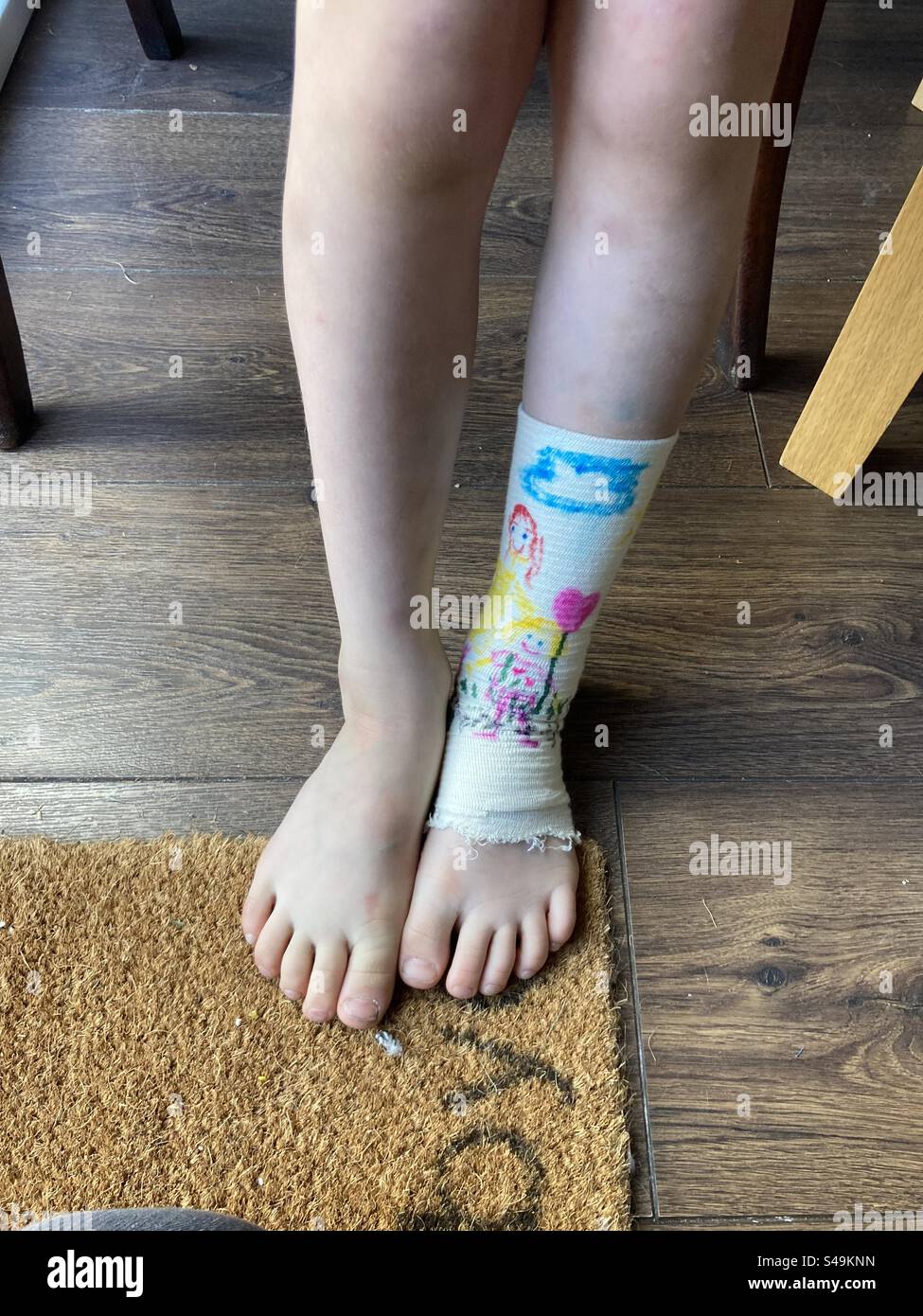 Child wearing a Compression Bandage that has been drawn on Stock Photo