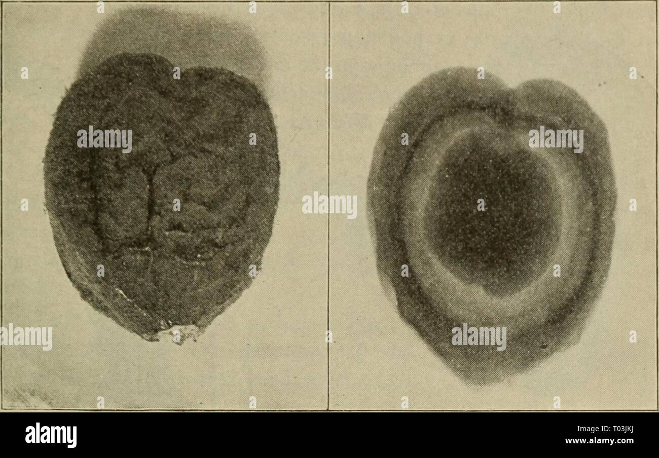 Elementary botany . elementarybotany00atki Year: 1898  FURTHER STUDIES ON GYMNOSPERMS. 215 developed entirely inside of the macrosporangium, and derives the nutriment for its growth from the cycas plant, which is the    Fig. 279. Macrosporangium ot Cycas revoluta Fig. 280. Roentgen photograph of same, show- ing female prothallium. sporophyte. Archegonia are developed in this internal mass of cells. This aids us in deter- mining that it is the prothal- lium. In cycas it is also called endosperm, just as in the pines. 430. If we cut open one of the mature ovules, we can see the en- dosperm (prot Stock Photo