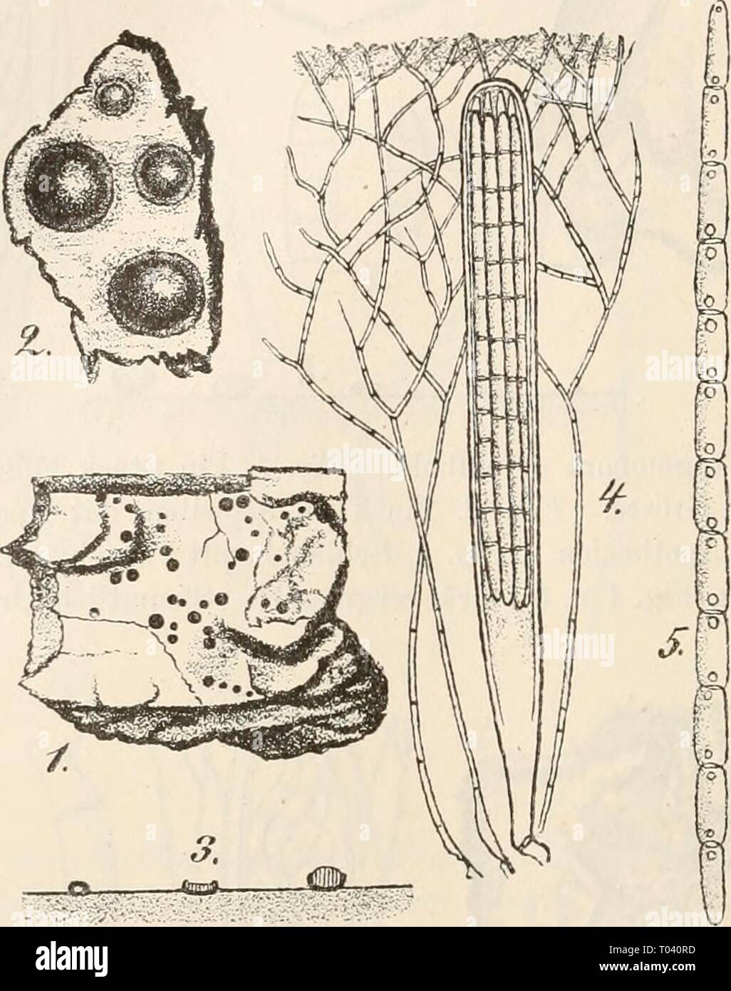 Dr. L. Rabenhorst's Kryptogamen-Flora von Deutschland, Oesterreich und der Schweiz . drlrabenhorstskr0103rabe Year: 1896  298 Bactrospora. Apothecien gesellig, kuglig sitzend, rundlich sich öffnend, schwärzlich, wachsartig. Schläuche keulig, oben abgerundet, dickwandig, 8 sporig. Sporen stäbchenförmig, gerade, —12 zellig, fast farblos, parallel gelagert, schon in den Schläuchen zerfallend. Paraphysen ästig, septirt, ein gefärbtes Epithecium bildend. Hypothecium farblos.    Fig. 1—5. Bactrospora dryina. Fig. 1. Ein Stück Eichenrinde mit dem Pilz in natürlicher Grösse. Fig. 2. Ein Theil derselbe Stock Photo