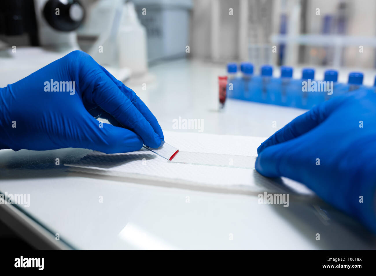 scientist prepare blood sample for research on microscope. Placing