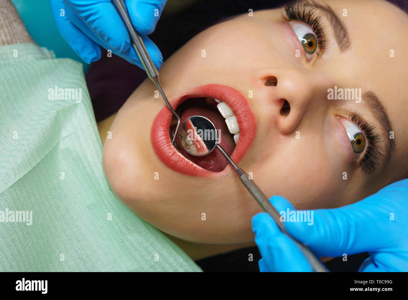 Dentist examines rear surface of woman's teeth. Young girl with open