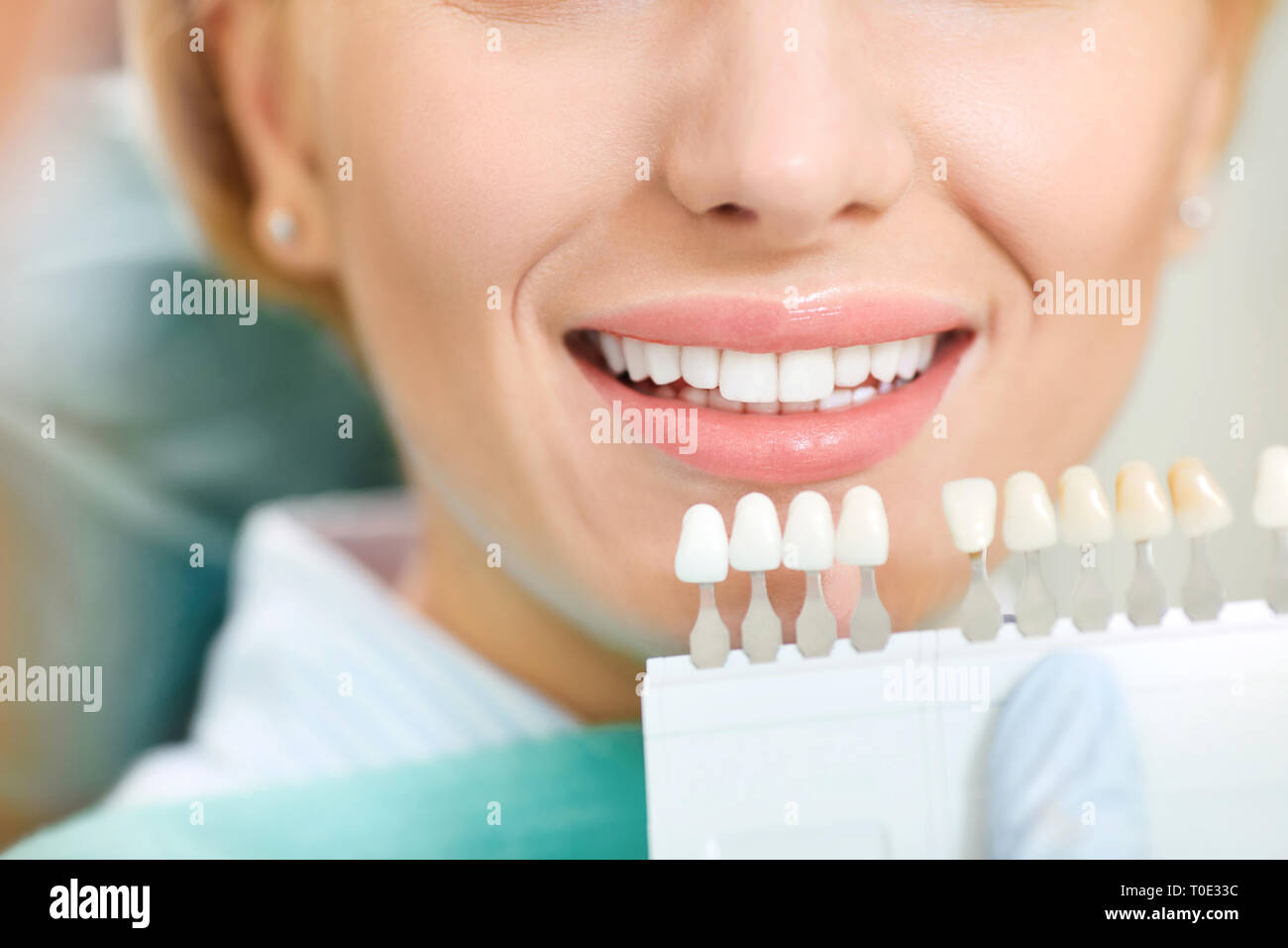 Teeth whitening dental clinic. Stock Photo