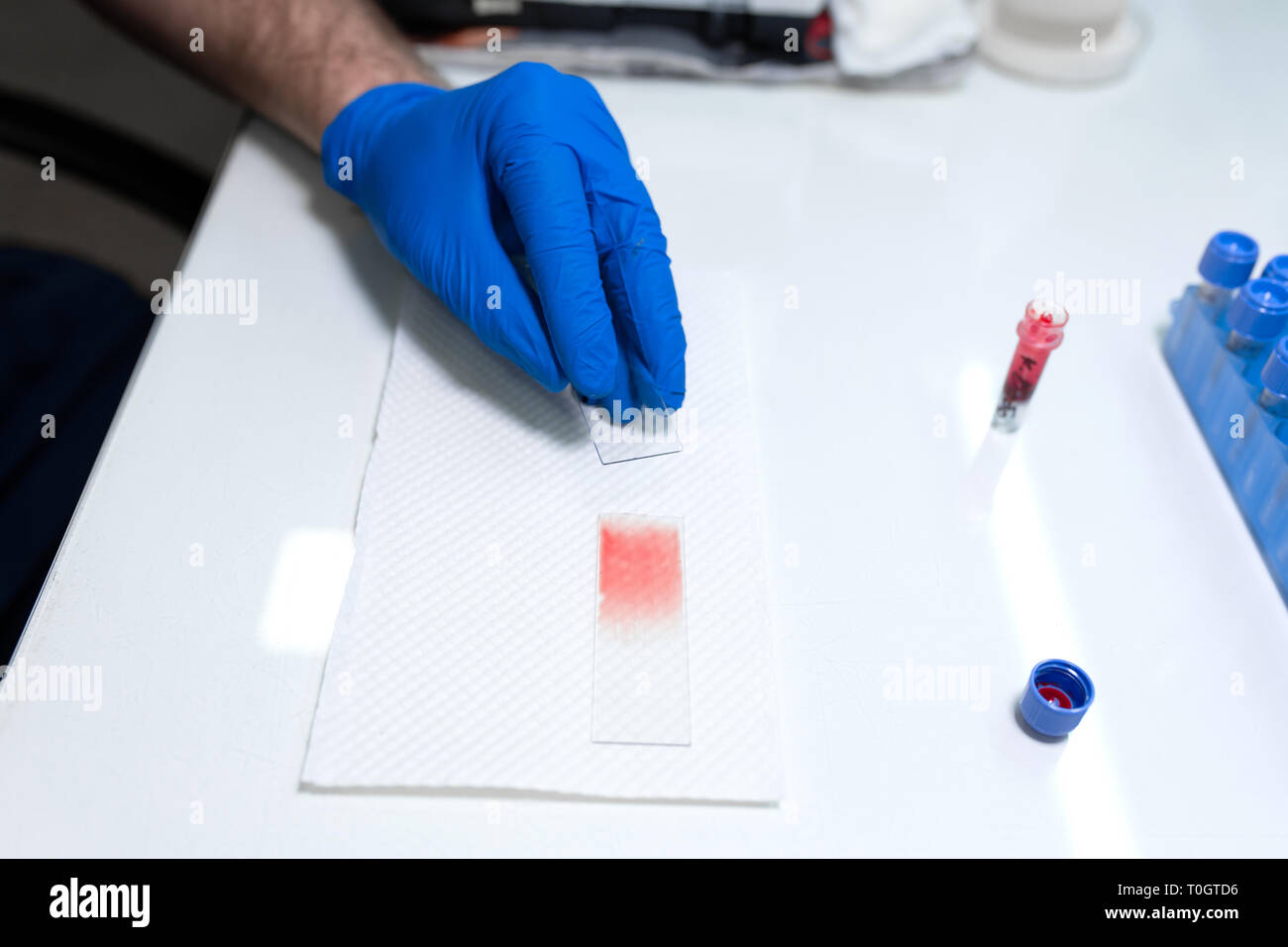 scientist prepare blood sample for research on microscope. Placing