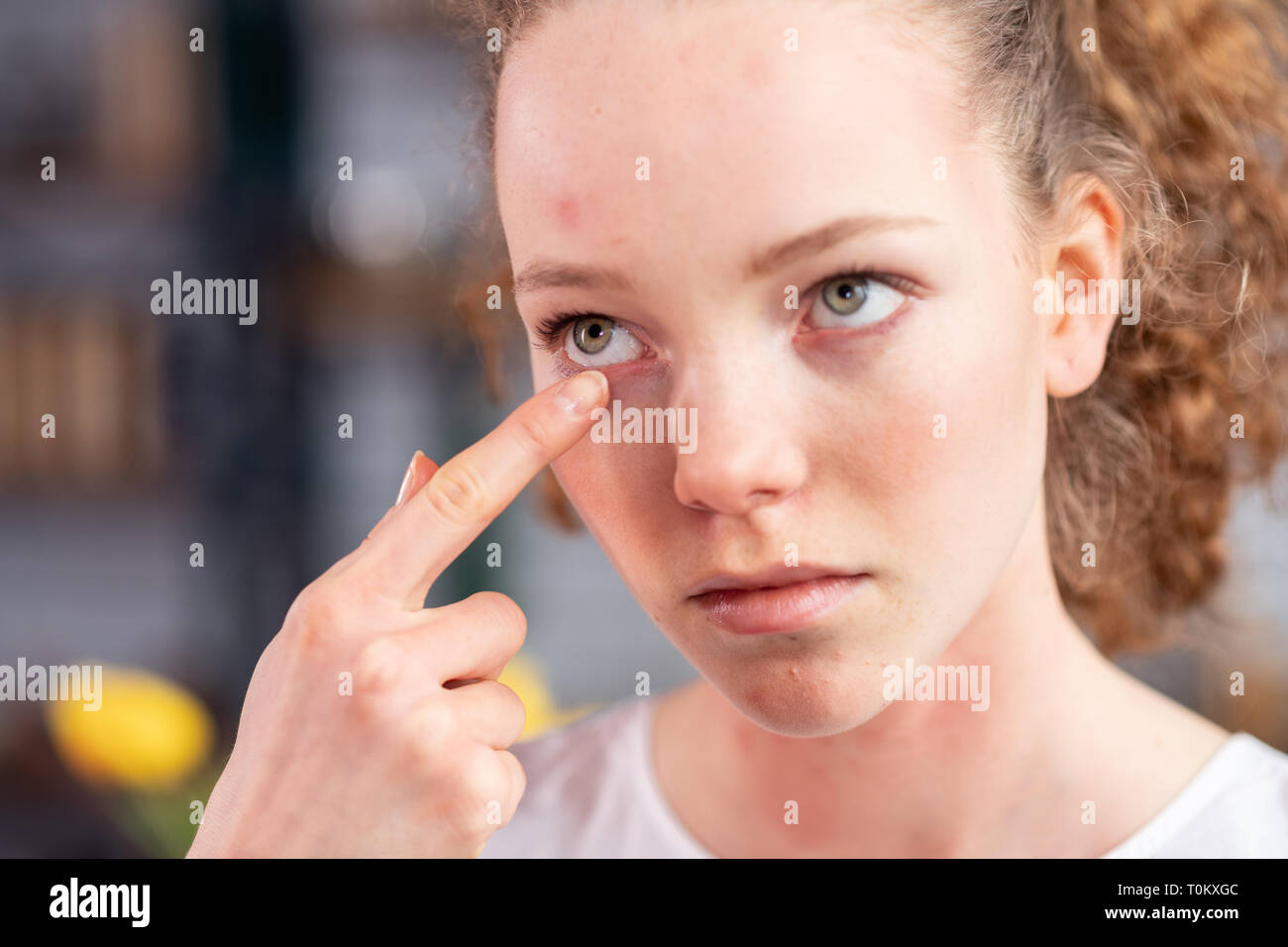 Unfortunate young lady with curly hair itching her eyelid Stock Photo