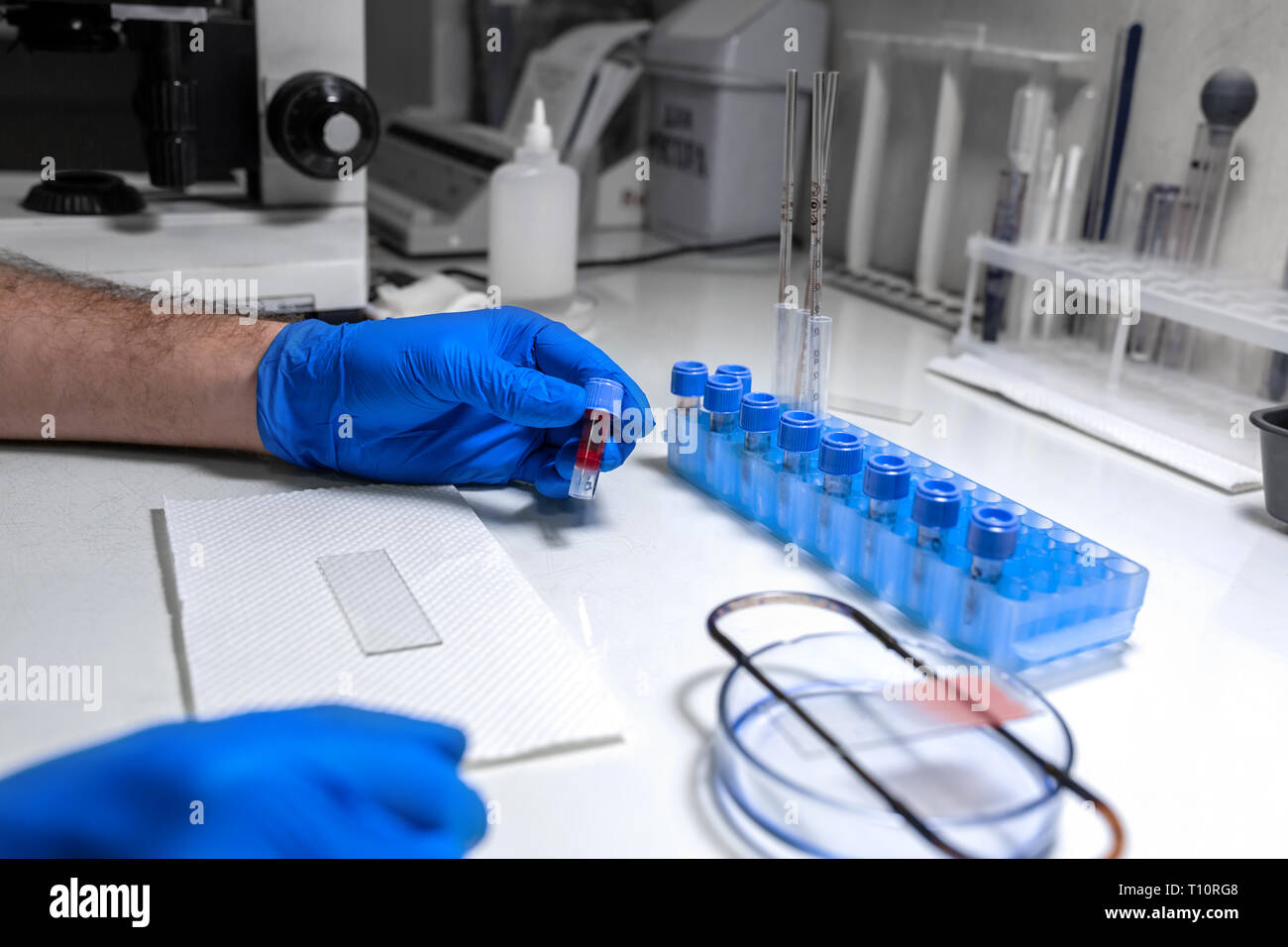 scientist prepare blood sample for research on microscope. Placing