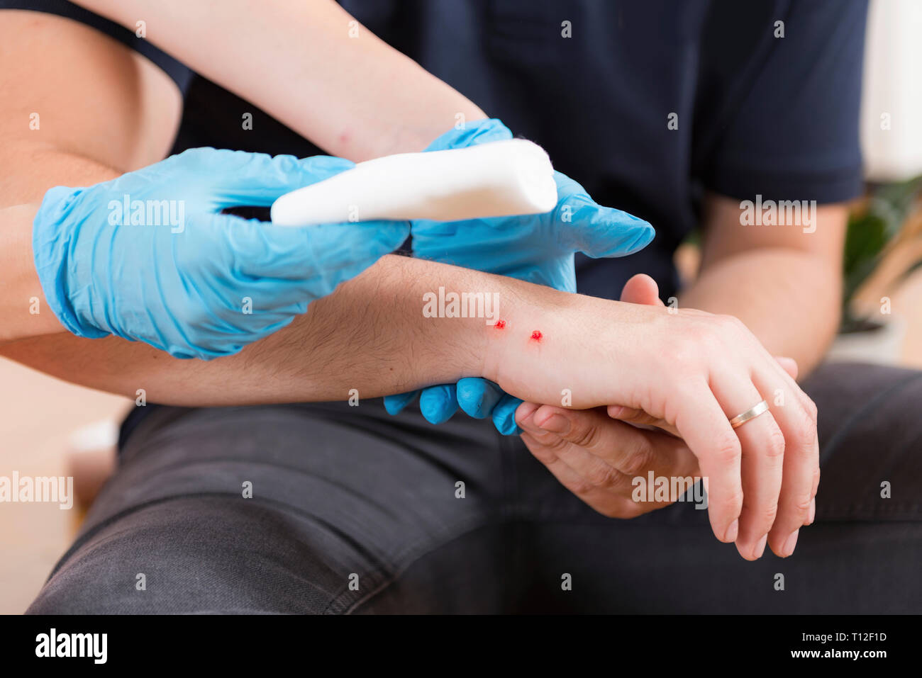 First aid training. Burn injury. First aid course Stock Photo Alamy